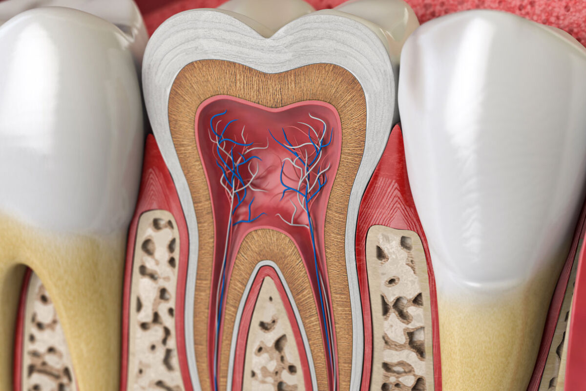 Image diagram of root canal